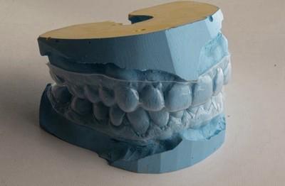 Custom Dental Retainer Set - 3
